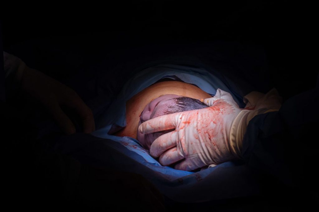 Fotografia de parto documental registrado pela premiada fotógrafa Claudia Ruiz. A história do dia mais importante da sua vida traduzida em imagens.